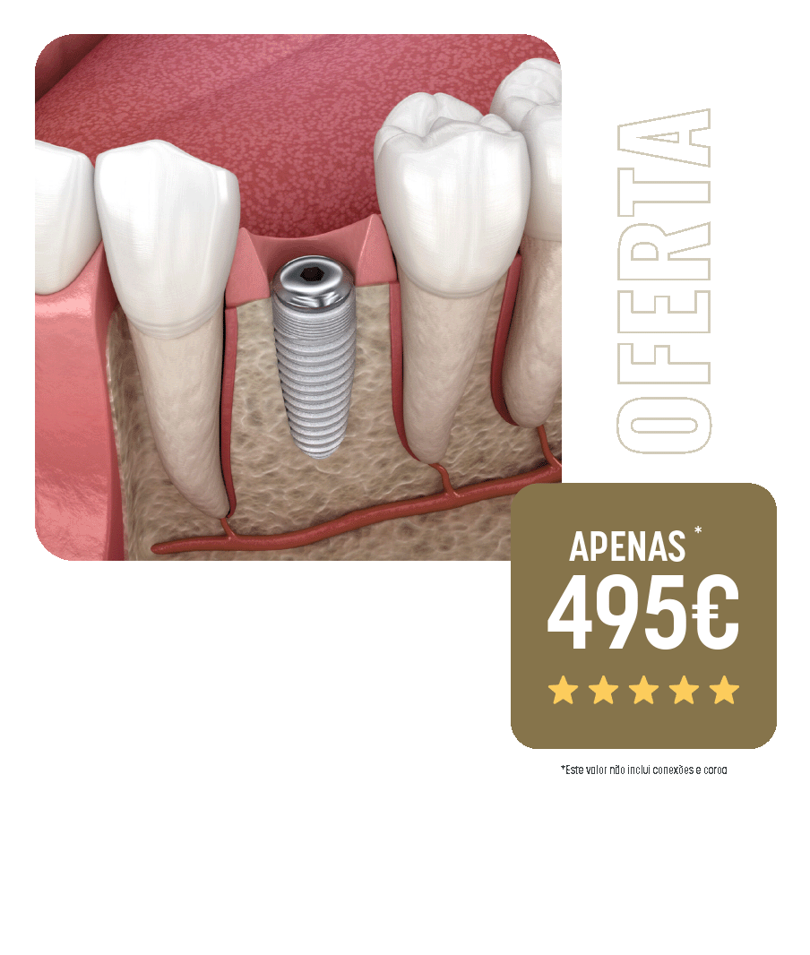 campanha implante dentario