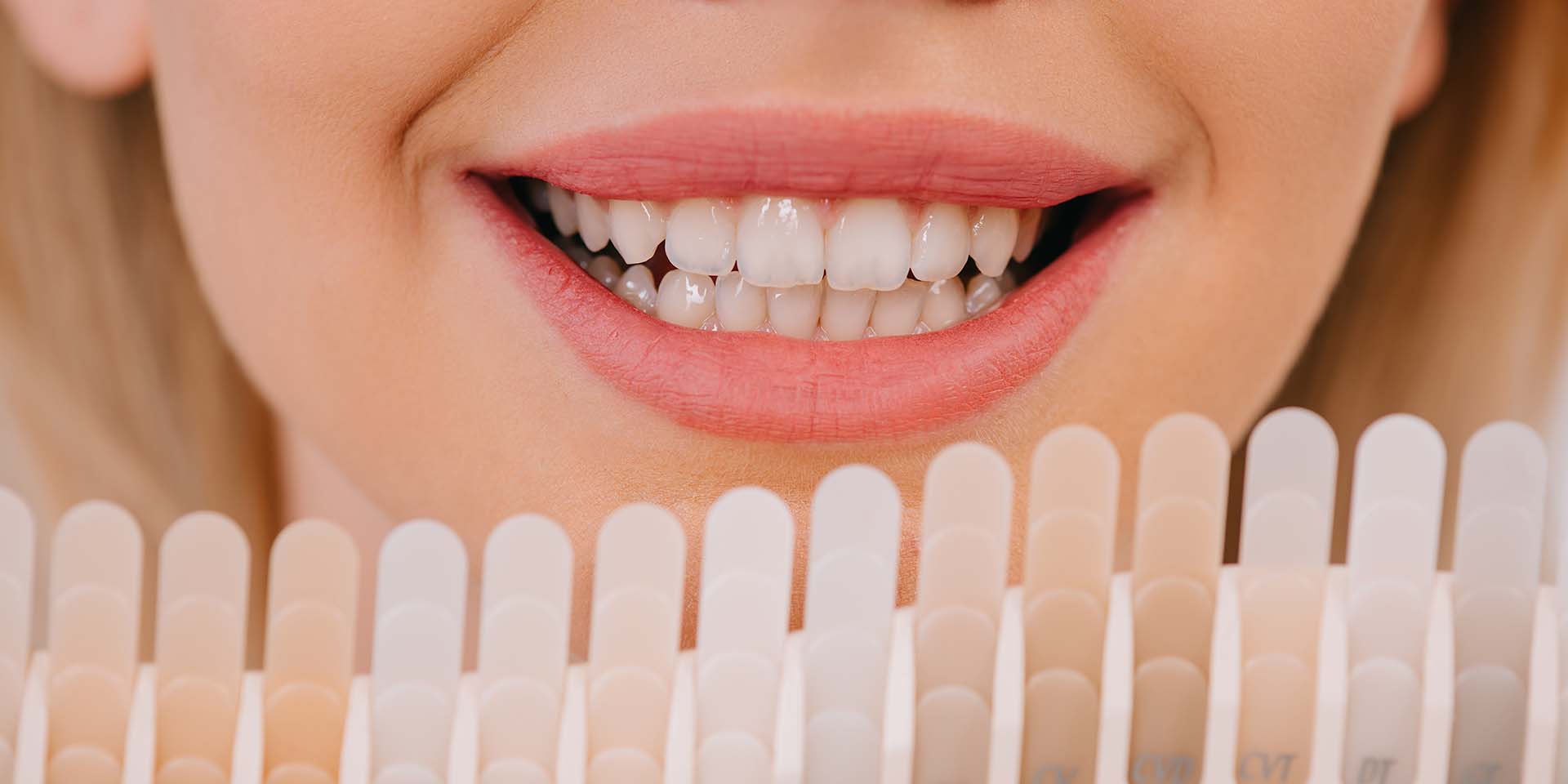clareamento dental