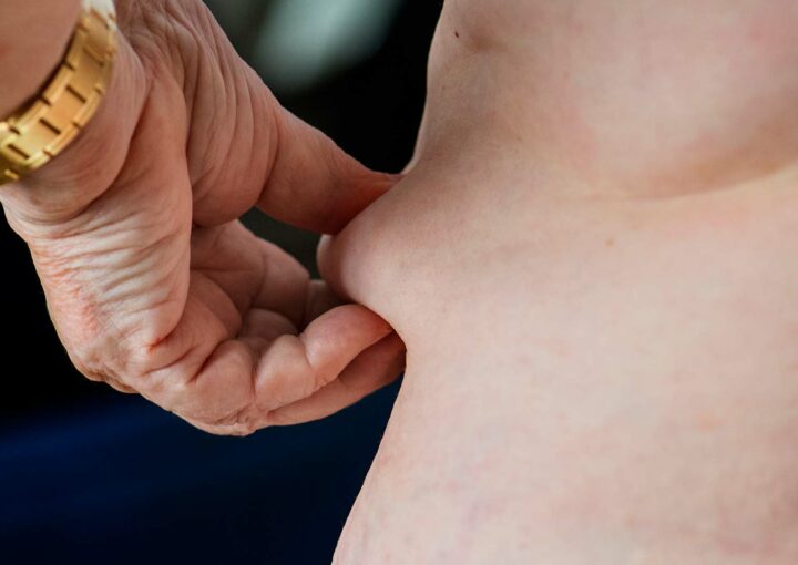 saúde oral e excesso de peso como a obesidade afeta a tua boca