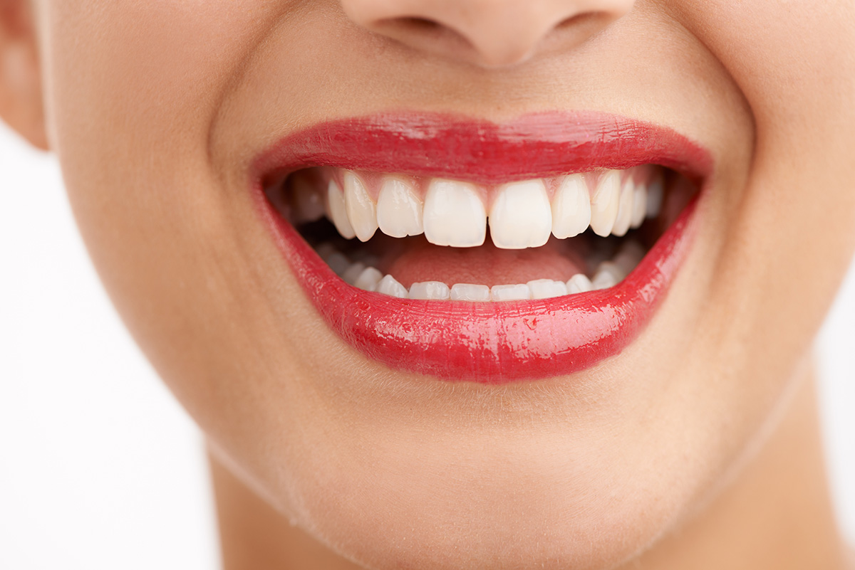 a shiny white smile 2025 04 06 11 33 17 utc