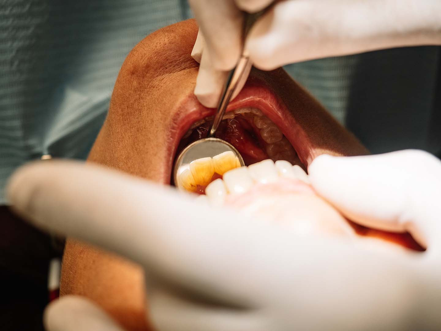 microbioma oral e intestino a estrada de duas vias que influencia a tua saúde