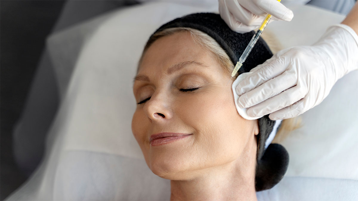 collagen biostimulation1