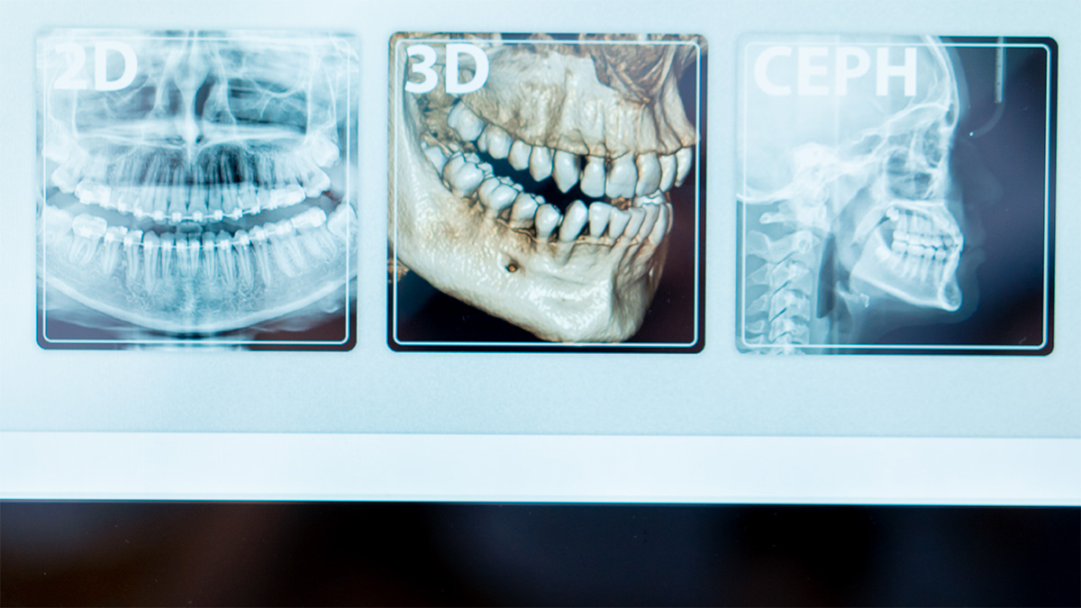 radiologia dentária 3d para quem e porquê1