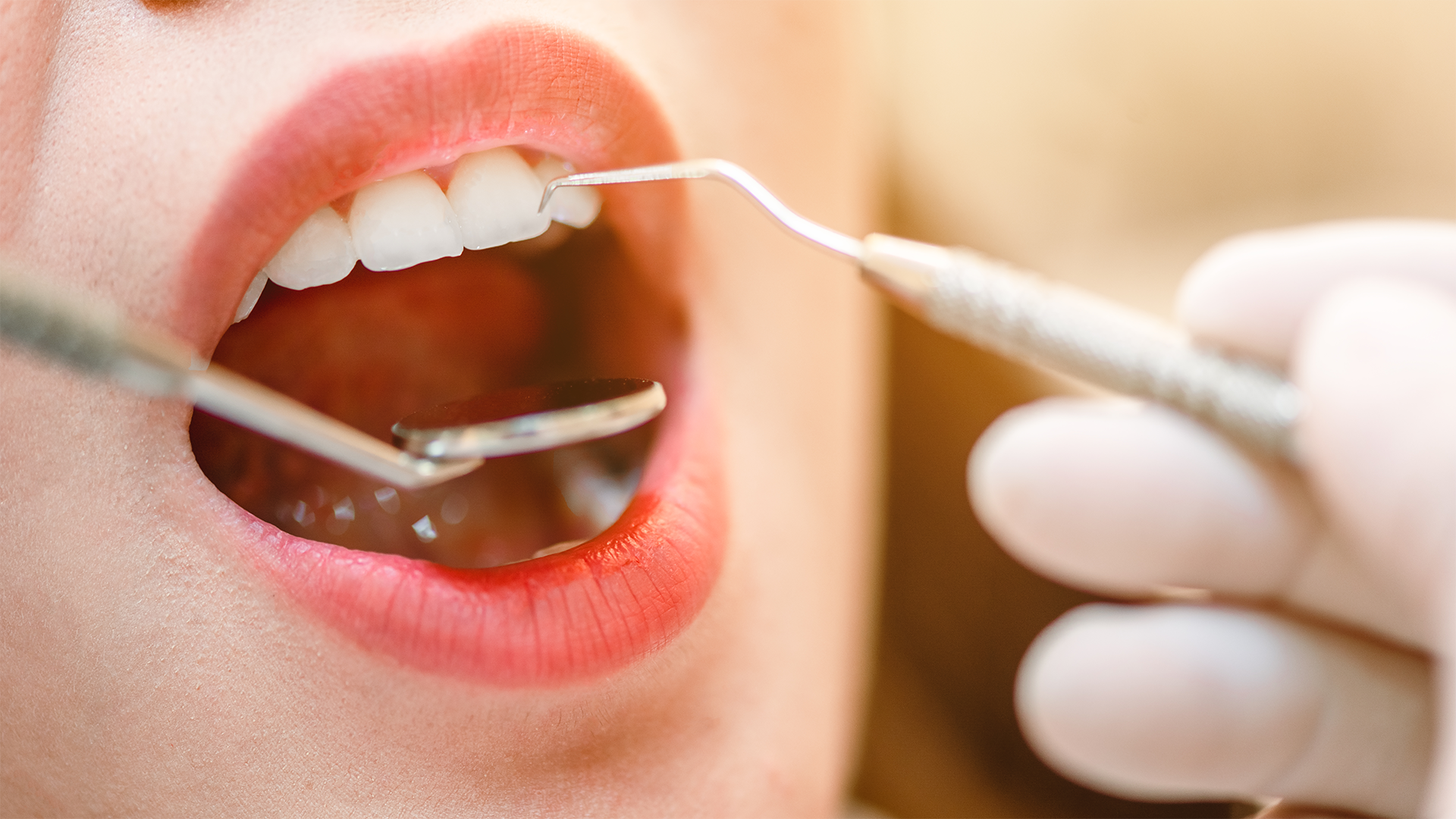 periodontite controlada ainda posso colocar implantes?