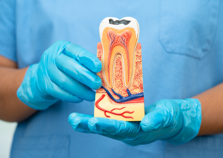 um dente pode precisar de desvitalização sem doer?