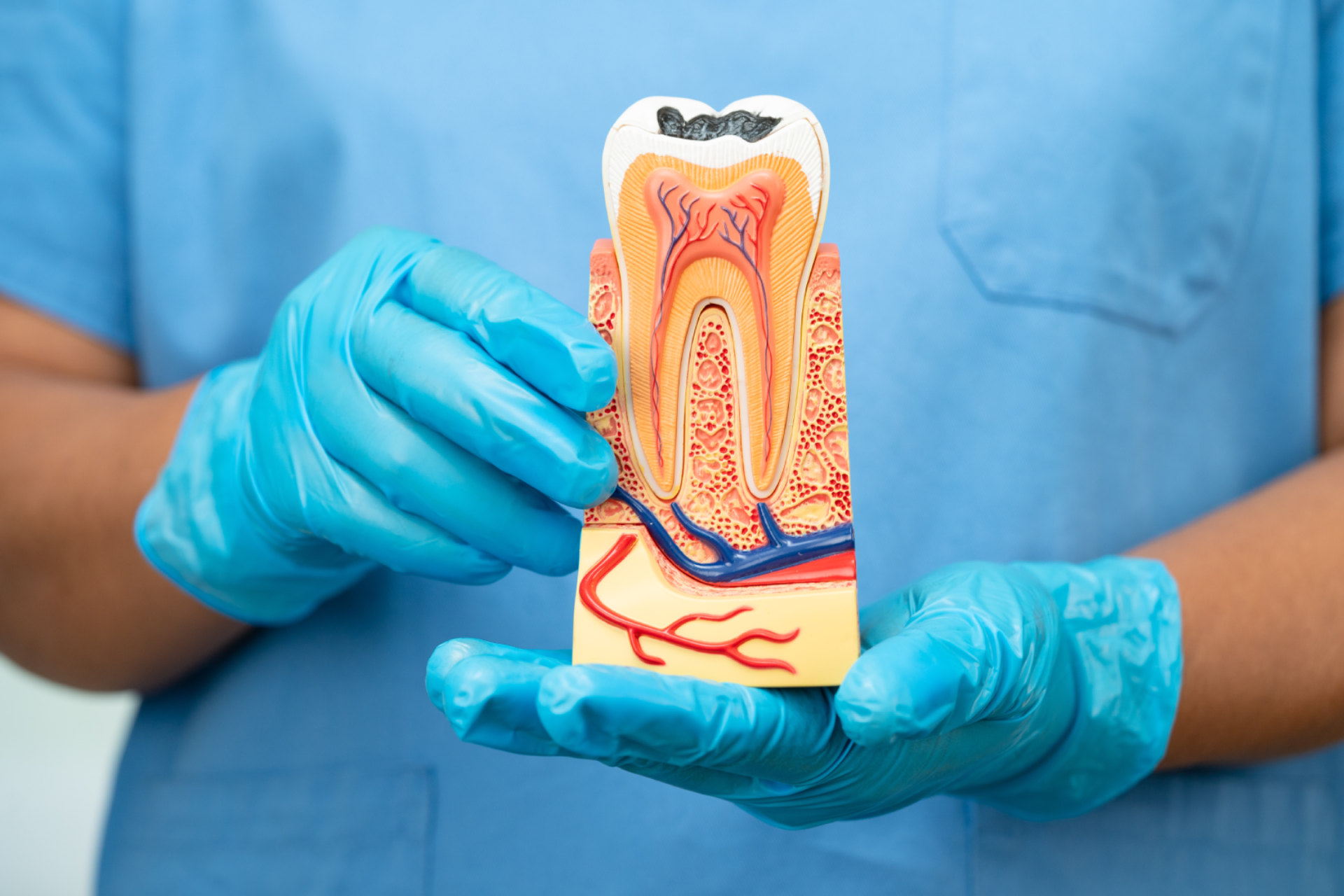 um dente pode precisar de desvitalização sem doer?